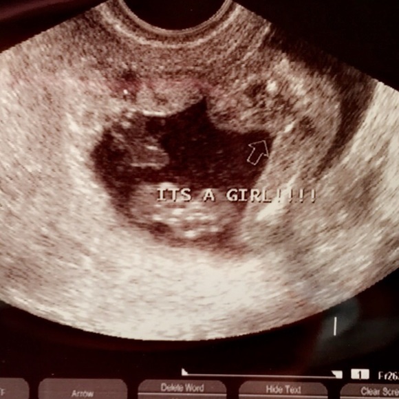 Meet your Posher, Dixie - Picture 1 of 1